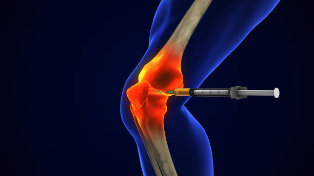 人体膝关节治疗，骨关节炎注射图片下载