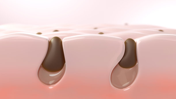 黑头堵塞毛孔图片下载