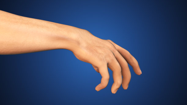 手部皮肤湿疹的医学概念图片下载