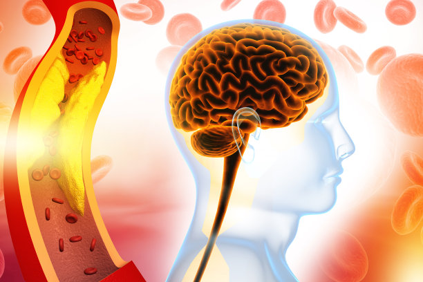 人的大脑与胆固醇阻塞动脉图片下载