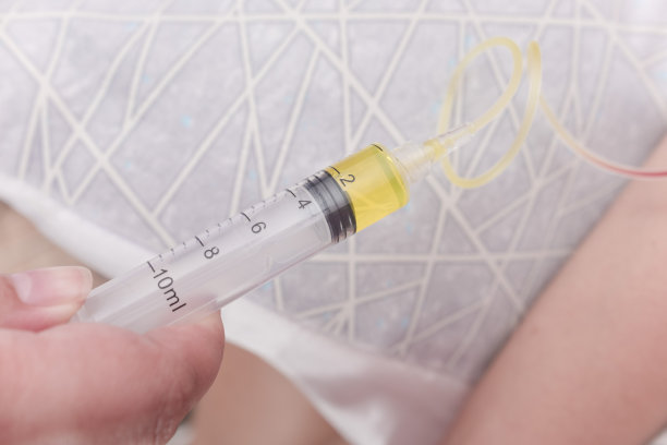 一位女性顾客在美容诊所接受谷胱甘肽静脉注射治疗。也叫谷氨酰胺静脉滴注。图片下载