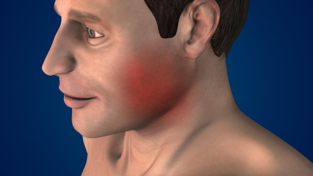 颌骨侧视图骨折图片下载