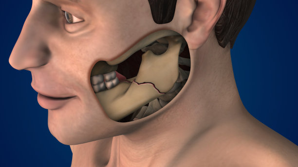 颌骨侧视图骨折图片下载