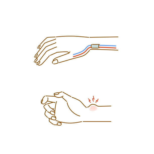 妇女更年期症状:De Quervain病插图图片下载