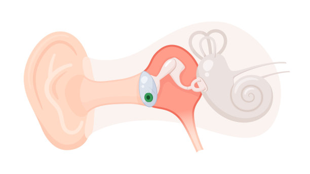 中耳炎图片下载