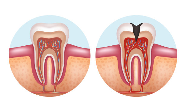 牙齿:人类牙齿的结构牙齿的解剖学。矢量插图。图片下载