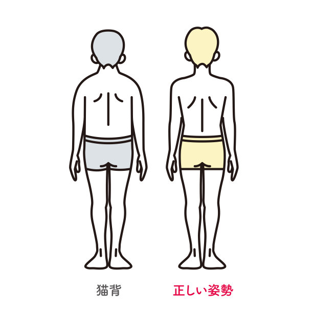 一个姿势正确的男人和一个驼背的男人的插图图片下载