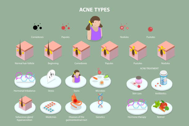 痤疮类型的三维等距平面矢量概念插图图片下载