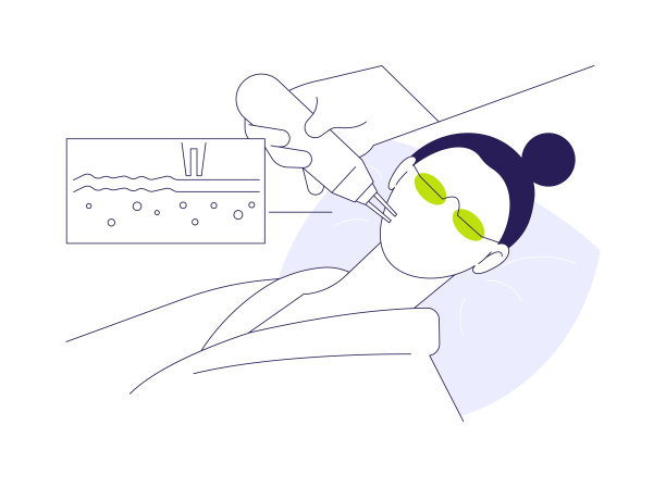 激光剥皮抽象概念矢量插图。图片下载