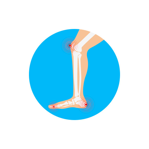 人腿疼痛区。信息图表的设计元素。矢量插图。图片下载