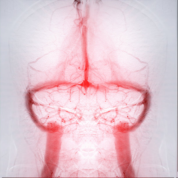 脑血管造影提供了大脑静脉系统的详细图像，有助于诊断。图片下载