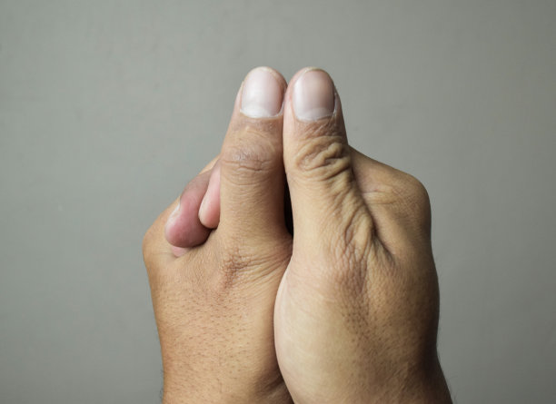 伤口是在拇指上切开的。伤口是由刀造成的图片下载