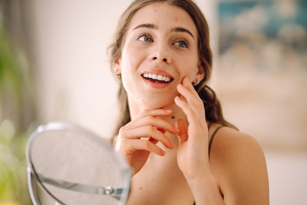 肖像的年轻女子没有化妆与痤疮皮肤。图片下载