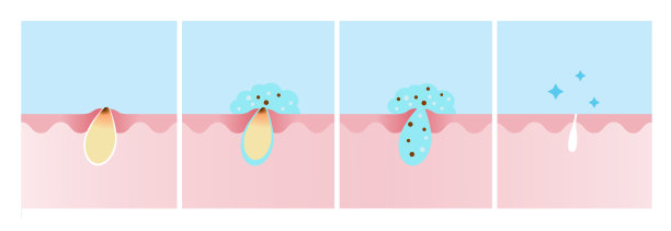 202407 -水杨酸图片下载