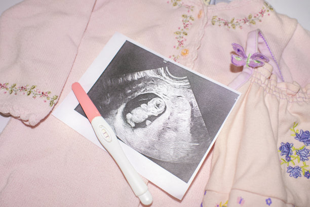 宝宝的超声波照片，验孕棒和粉色衣服图片下载