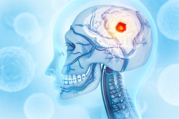 颅骨骨癌的视觉概念。三维演示图片下载