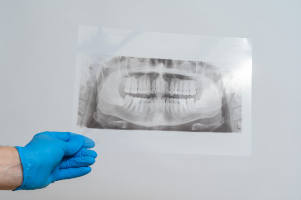 颌骨x线图像。病人有牙齿的口腔x光片图片下载