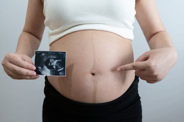 一名孕妇拿着婴儿的超声波照片，微笑着凝视着这张照片。超声波显示了胎儿发育的清晰画面，捕捉到了母亲和期待的珍贵时刻。图片下载
