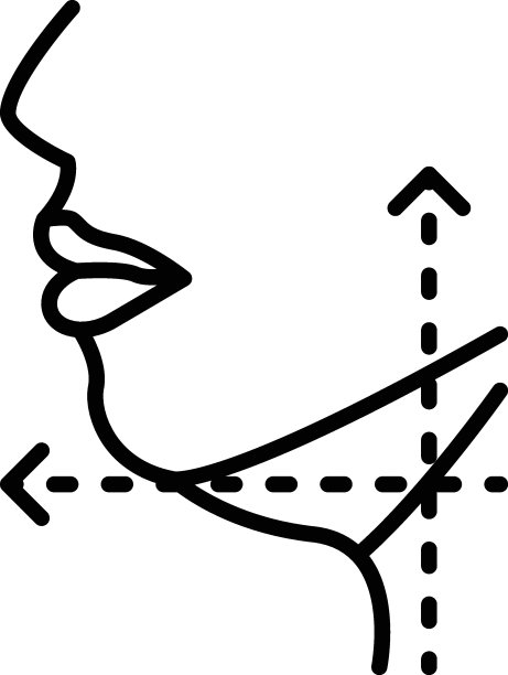 双下巴去除概念，摆脱多余的脂肪下的下巴矢量图标设计，美容或美容师符号，美学美容轮廓符号，美容治疗股票插图图片下载