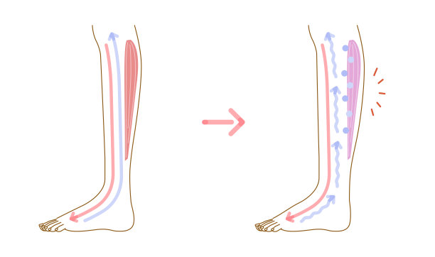 腿部肿胀:肿胀原因说明(横截面)图片下载