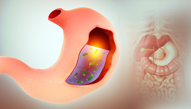 胃里的幽门螺杆菌，胃病。三维演示图片下载