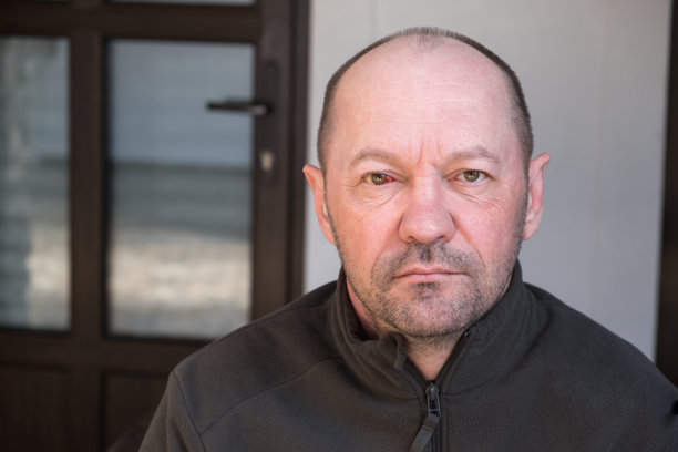 血液在眼睛的血管破裂。血压。受伤。眼球受打击而受伤。成年男子看着镜头翻白眼。压力和疲劳对人体的影响图片下载