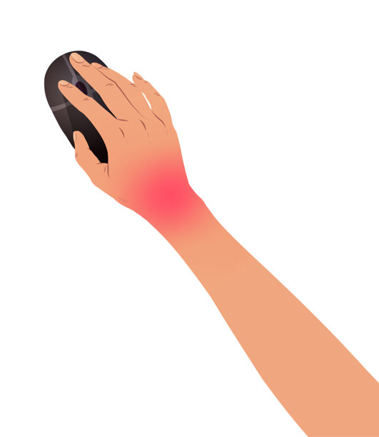 矢量插图的手与腕管综合征图片下载