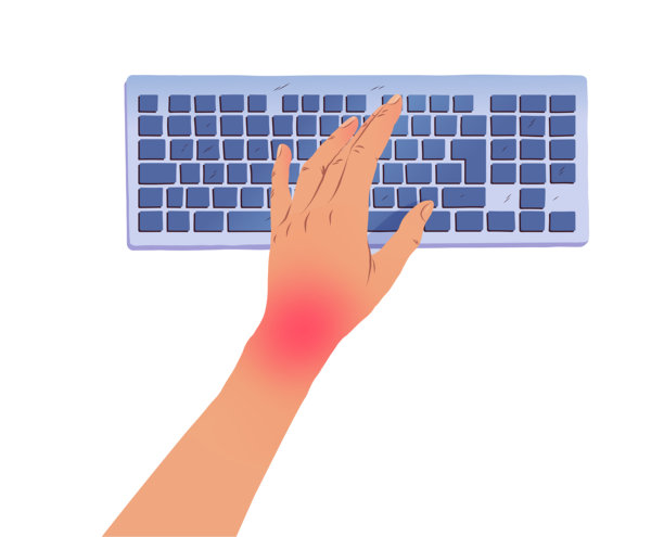 左手有腕管综合症图片下载