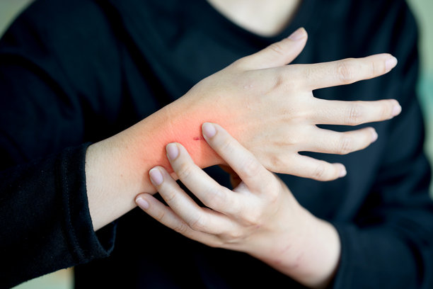 触摸手腕的人有突出的红色区域，表示疼痛或不适。损伤、关节疼痛或炎症的概念。图片下载