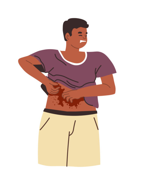 有皮肤发痒皮疹的人图片下载