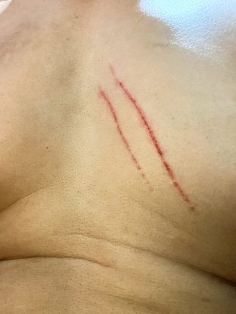 猫抓伤图片下载