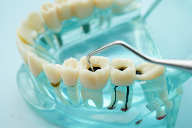 牙齿模型与工具牙医使用的清洁护理治疗。图片下载
