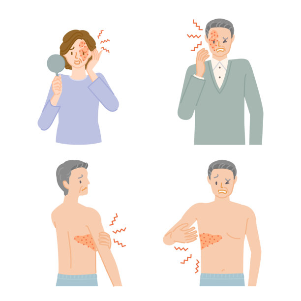 带状疱疹:插图集中年男女的疼痛，瘙痒和肿胀图片下载