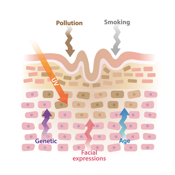 皮肤皱纹原因图解矢量素材图片下载