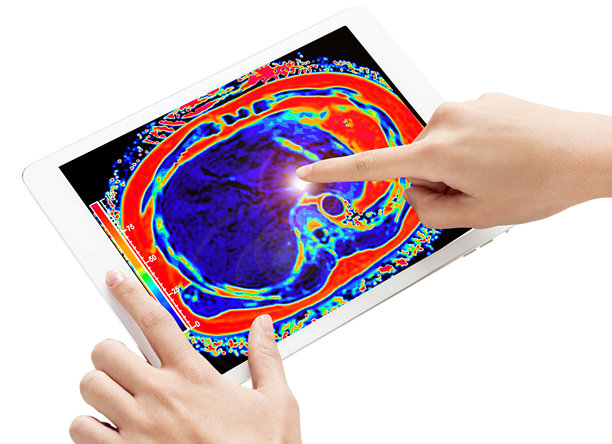 一只手握着一台平板电脑，显示腹部的详细MRI PET扫描图像（轴向视图），背景为白色。剪切路径。图片下载