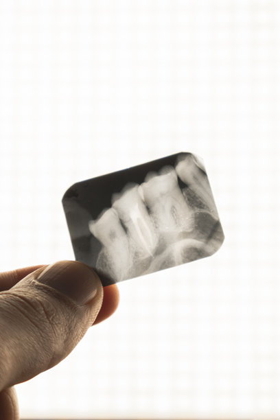 医生正在检查人类牙齿和神经的X光或MRI的竖直照片。医疗治疗概念。牙科健康、口腔卫生和牙科疾病的诊断。图片下载