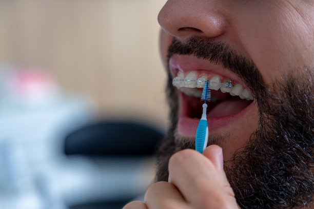 戴着陶瓷牙套的牙齿歪斜的男子正在用牙刷清洁牙套周围。图片下载