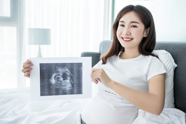 怀孕的亚洲妇女微笑着拿着她的超声波扫描照片图片下载