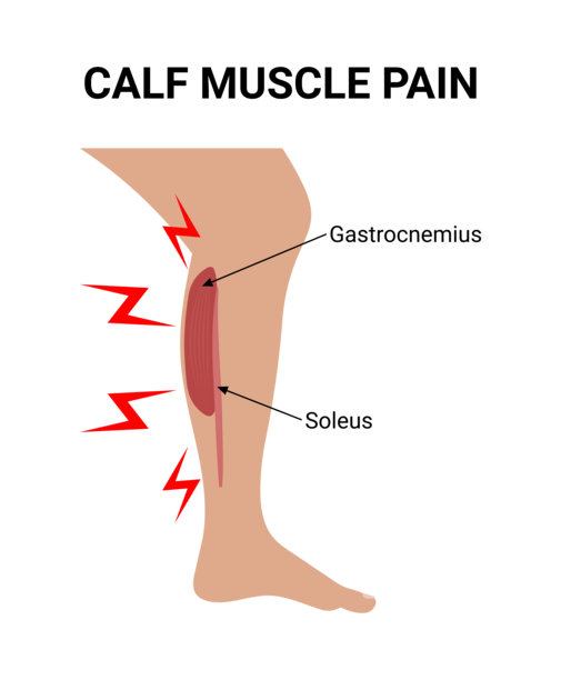 小腿肌肉疼痛矢量插图图片下载