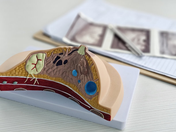 检查女性的照片和超声结果图片下载