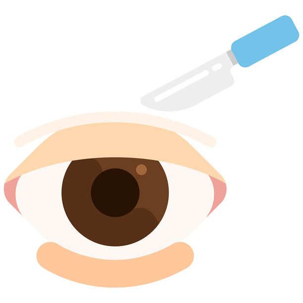 双眼皮手术 眼睑成形术 整形手术图片下载