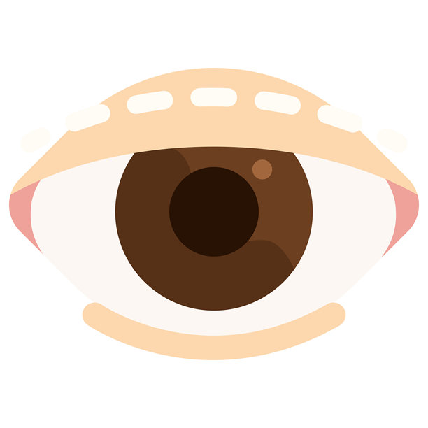 双眼皮手术 眼睑成形术 整形手术图片下载