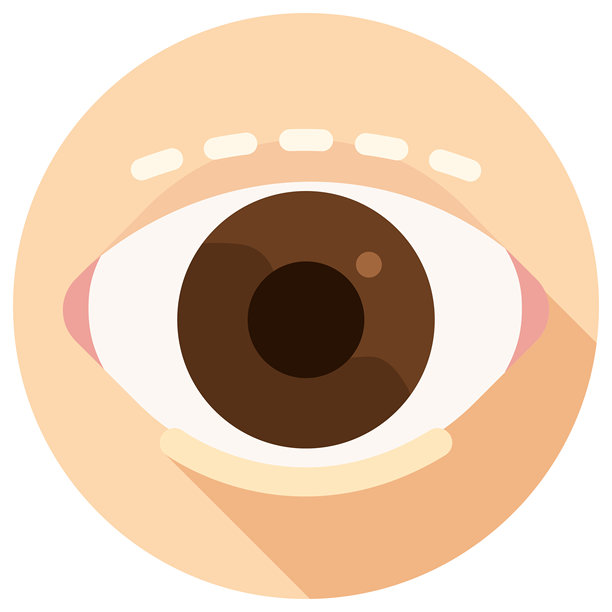 双眼皮手术 眼睑成形术 整形手术图片下载