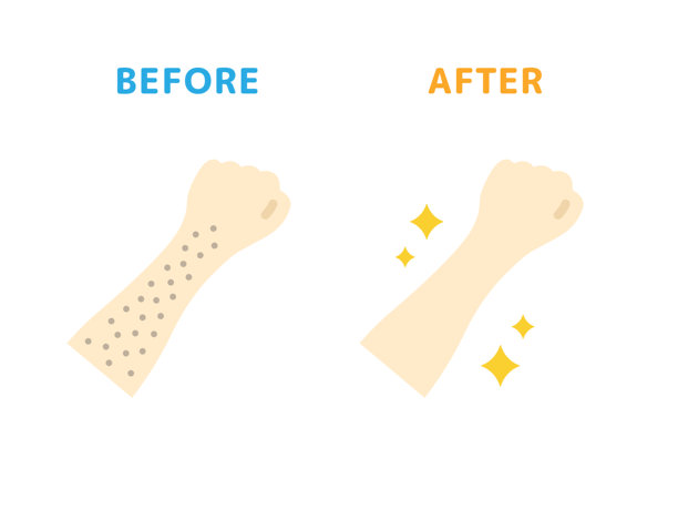 手臂脱毛前后的图标插图图片下载