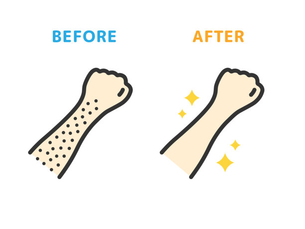 手臂脱毛前后的图标插图（线条绘制彩色）。图片下载