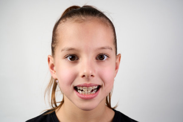 戴着牙齿矫正器的小女孩盯着镜头，特写。嘴里有正畸托槽或牙齿矫正器的孩子。儿童牙科。图片下载