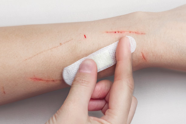 女人的手在给自己的手贴上创可贴。猫、狗、野兽的抓伤，摔倒的特写照片。图片下载