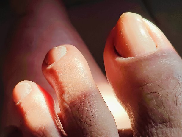 人腿皮肤纹理特写，腿部指头和指甲特写照片图片下载