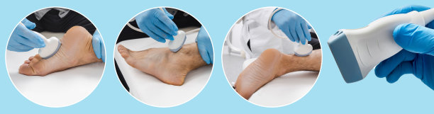 使用超声诊断对受伤患者的脚和踝关节进行复杂检查的医学照片拼贴图片下载