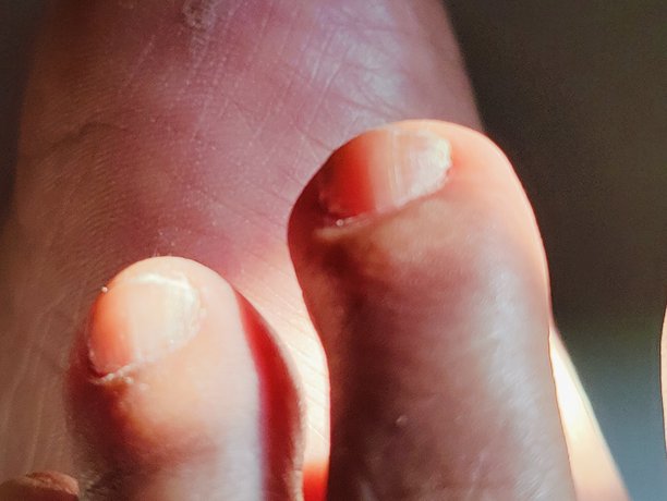 男人腿部手指特写照片，聚焦皮肤纹理细节图片下载